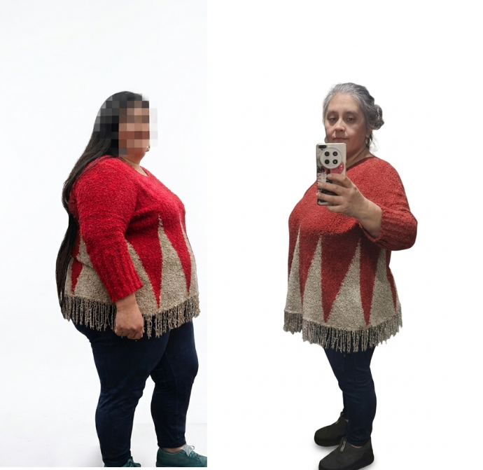 antes y despues 2